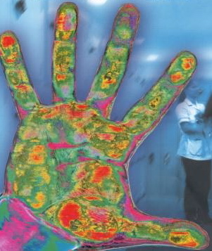 A scan of a hand loaded with germs and bacteria