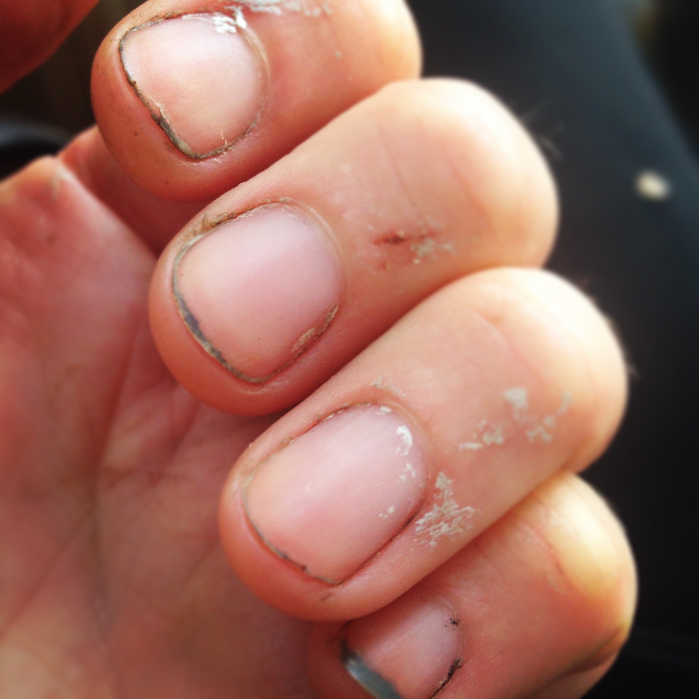 Should workers in assisted living facilities be allowed to have fake nails  or long nails?