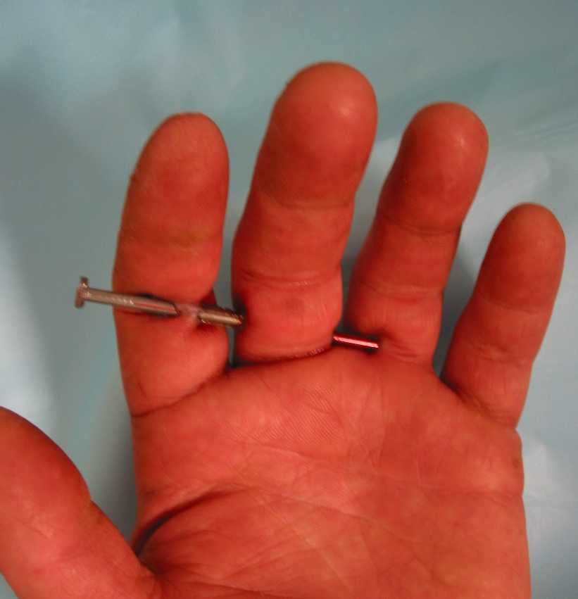 a hand with a nail piercing through 3 fingers