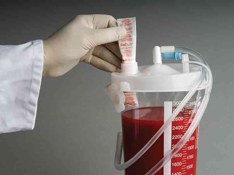 SaniSorb is used in a surgical blood container